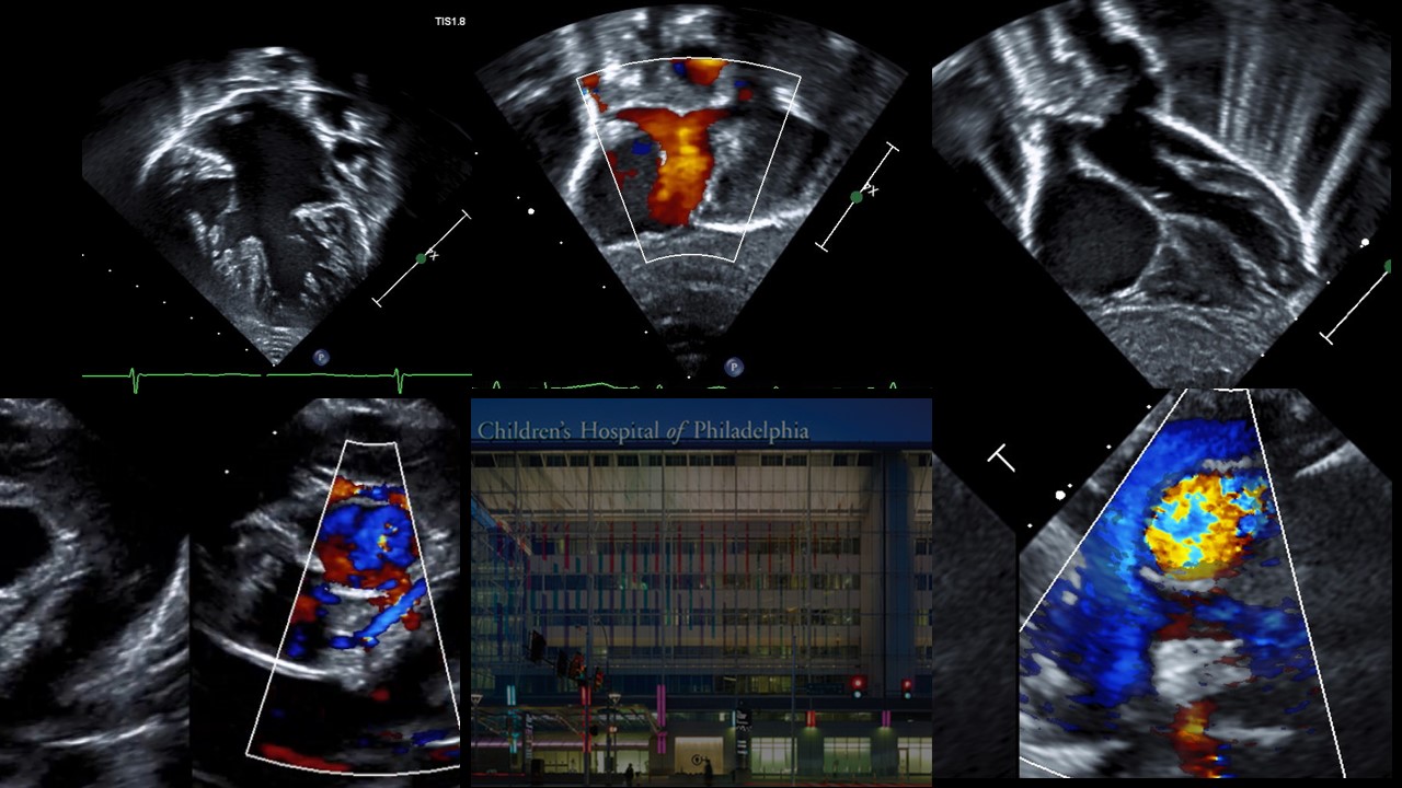 2nd Annual Imaging Congenital Heart Disease: From First Beats to Peak Performance Banner