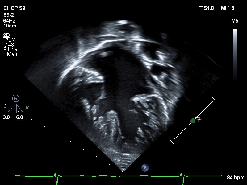 Imaging Congenital Heart Disease Across the Lifespan with Echocardiography: A Neonatal to Adult Approach Banner